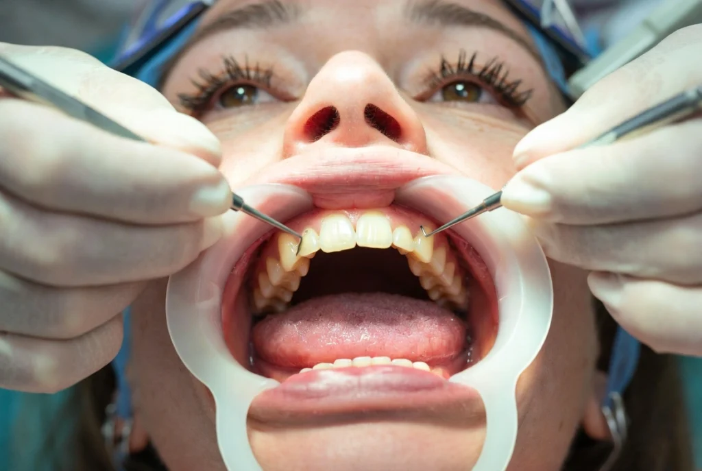 Tooth extraction services in Lahore