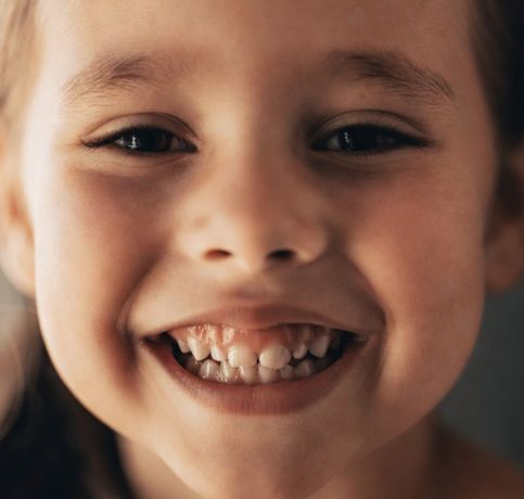 Crooked teeth problem