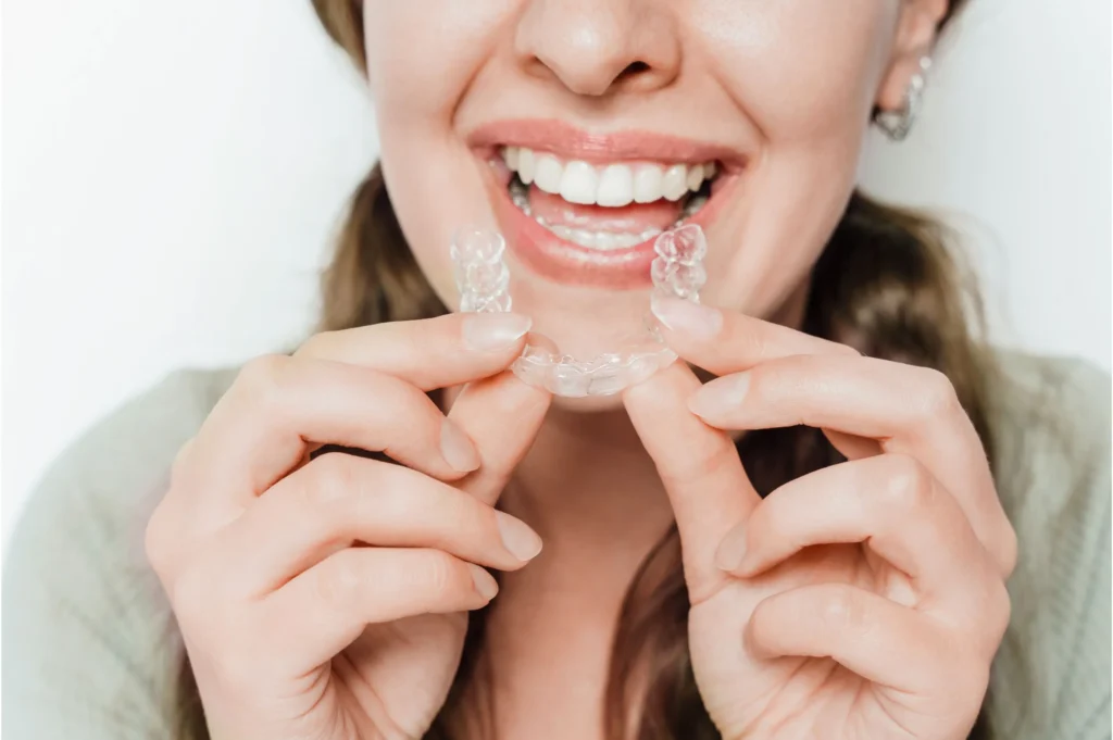 Invisalign in Lahore - Clear Aligners