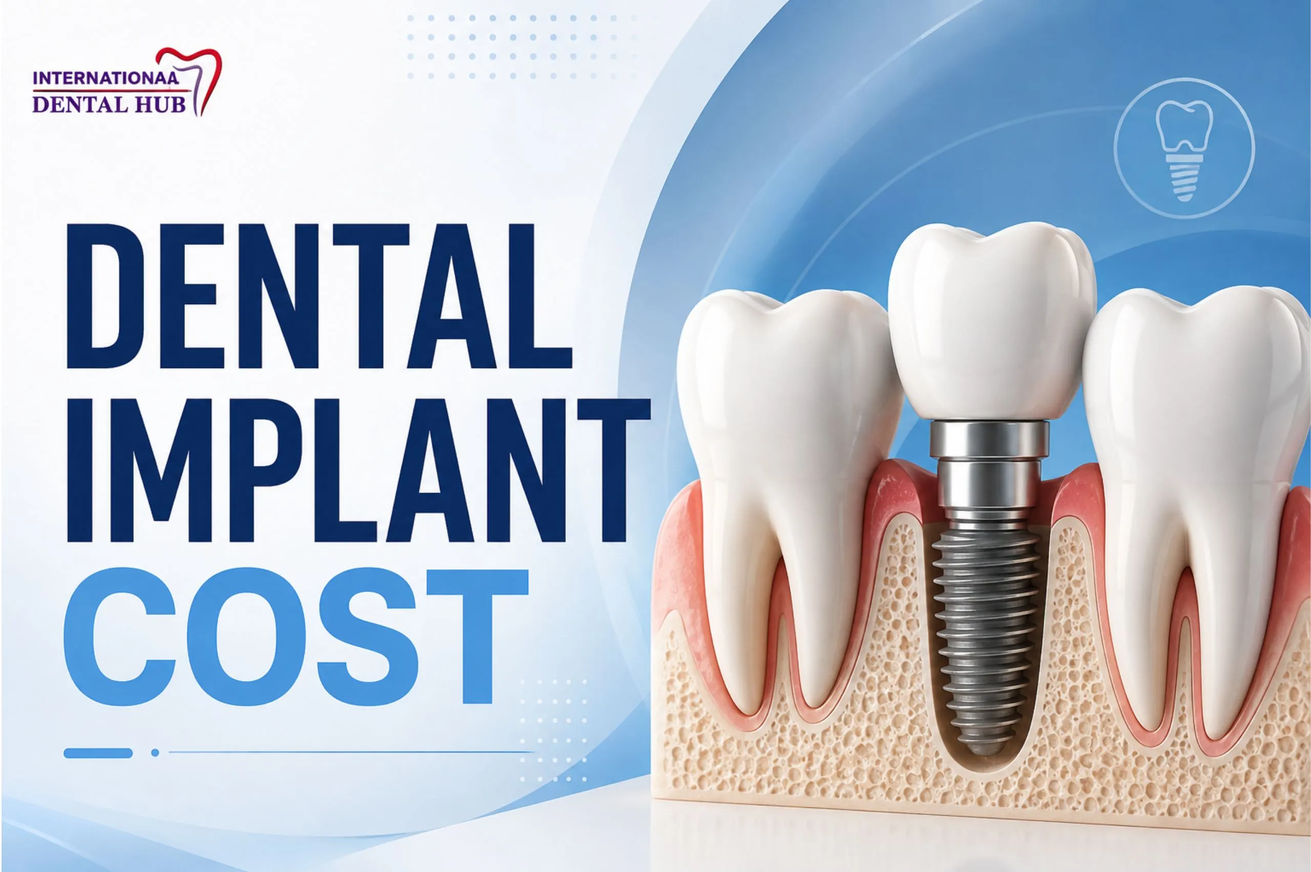 Dental implant cost in lahore, pakistan