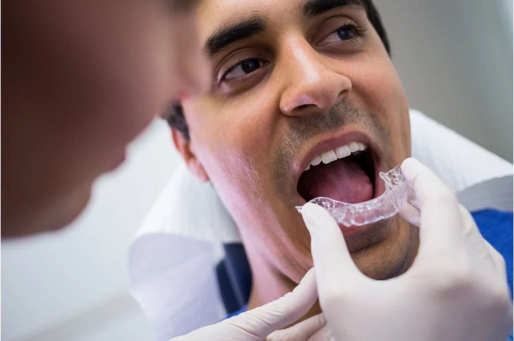mouth guards in lahore at Inernational Dental HUB